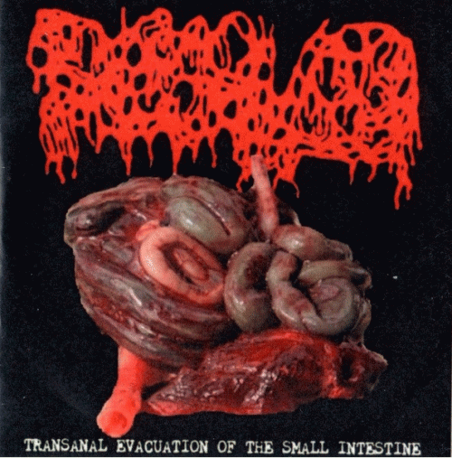 Dissolved : Transanal Evacuation of the Small Intestine